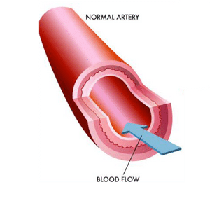 normal artery