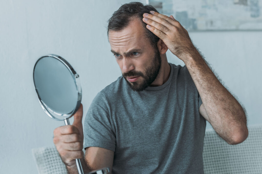 bearded middle aged man with hair loss looking at mirror